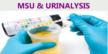 Mid Stream specimen of urine (MSU) and urinalysis