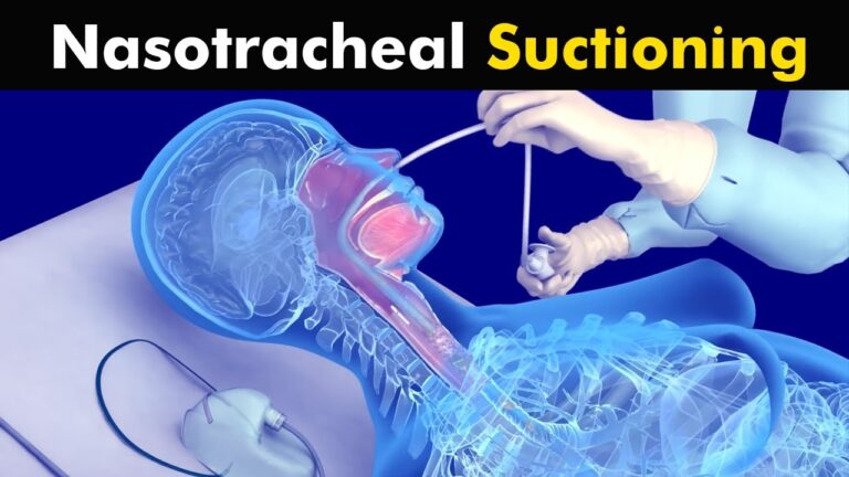 Nasopharyngeal Suctioning – NMC OSCE Skill Station