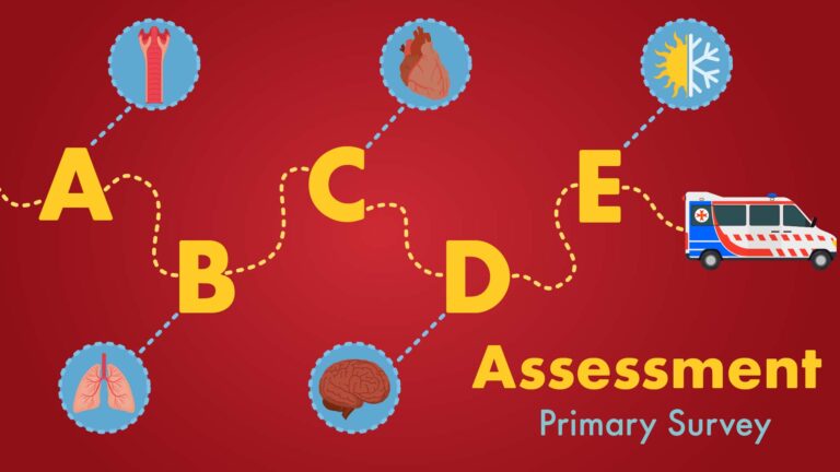 How to Perform Correct A to E Assessment for the NMC OSCE