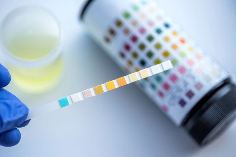 Understanding MSU and Urinalysis: NMC OSCE